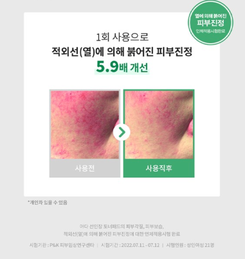 3 선인장 토너패드4.png